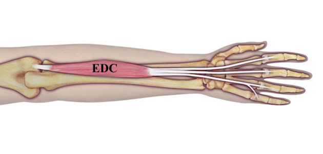 Extensor Digitorum Communis (EDC)