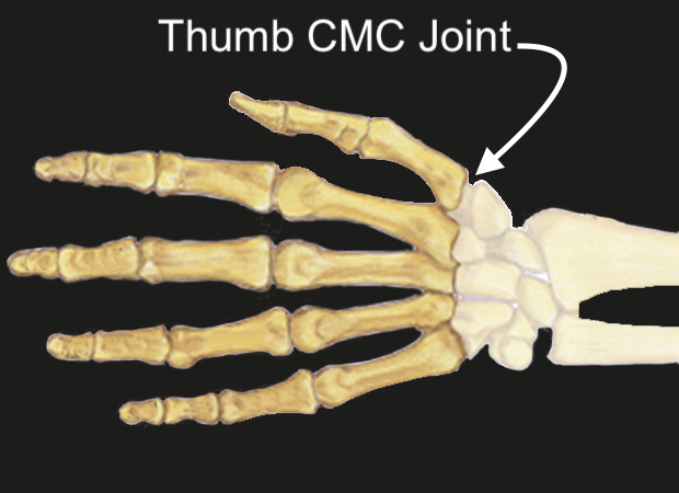 CMC joint 