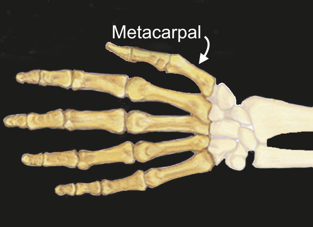  Thumb Metacarpal Bone Diagrammatic View