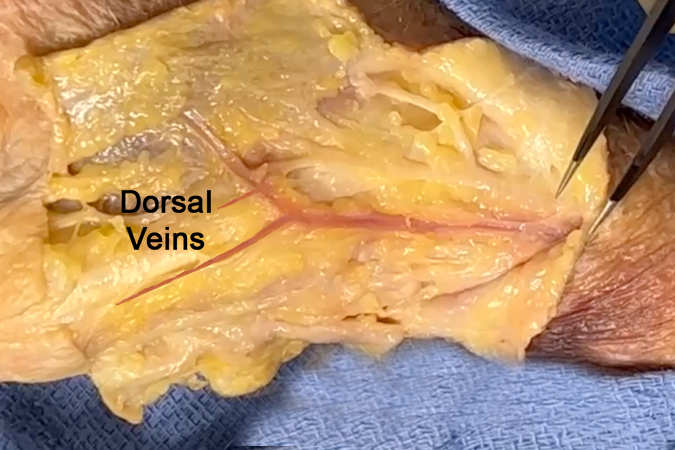 Dorsal Thumb Veins 
