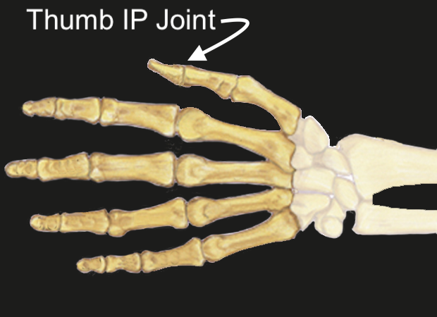 Thumb IP Joint diagrammatic view