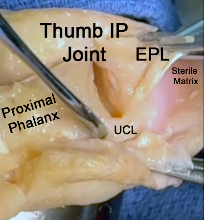 Thumb IP Joint anatomic view