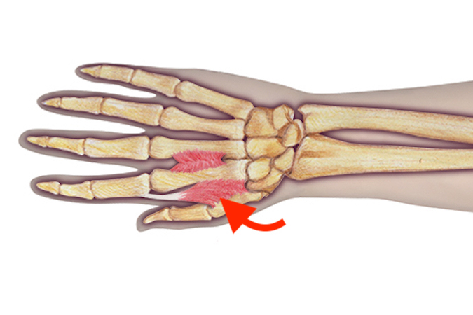 First dorsal interosseous muscle (red arrow). 
