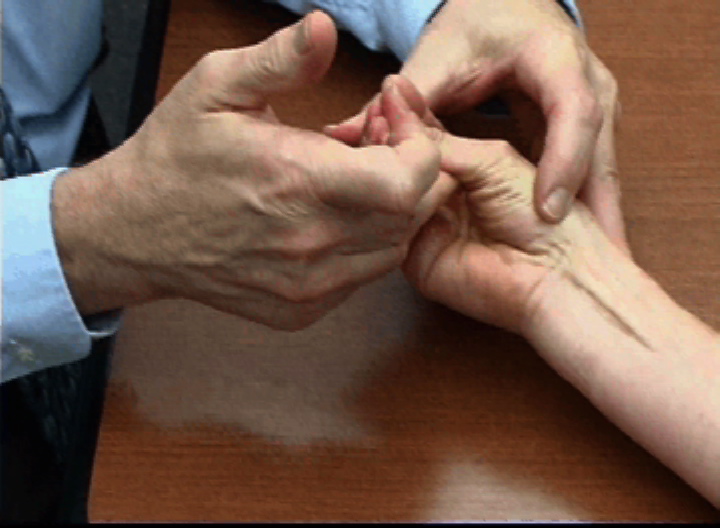 The median nerve innervated muscles: abductor pollicis brevis, the flexor pollicis brevis superficial head, and the opponens pollicis (APB, FPB, & OP) are tested together as a single unit. Their contraction is assessed while applying resistance.