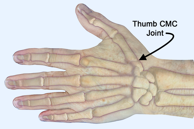 Relationship of thumb CMC joint to thumb soft tissues.