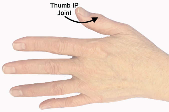 Location of thumb IP joint on physical exam.