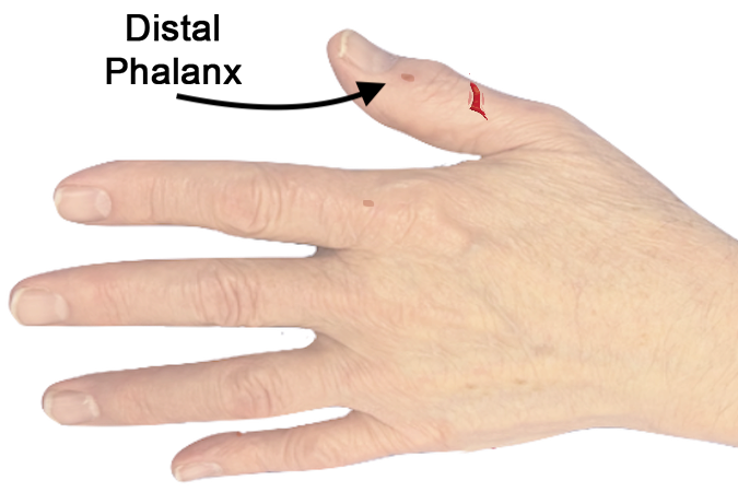 Note location of the distal phalanx