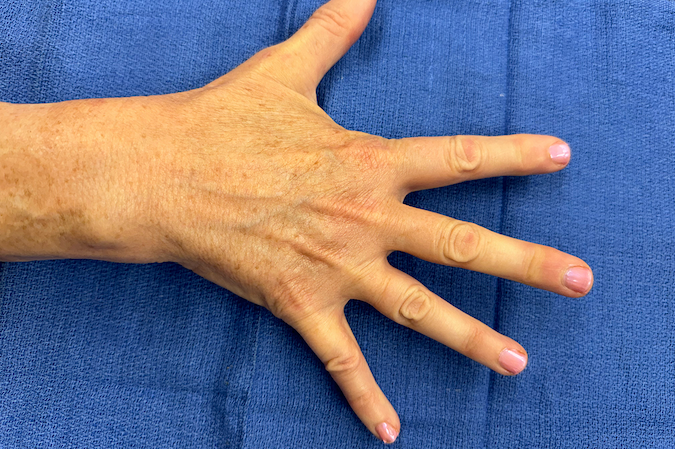 The dorsal interosseous muscles abduct the fingers.