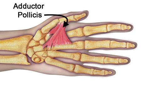 Adductor pollicis. Note the transverse and blue heads.