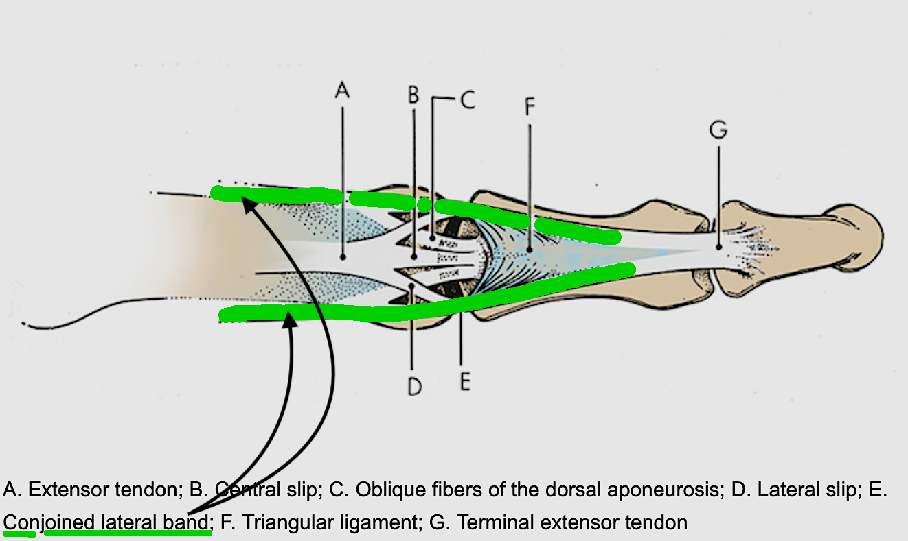 Conjoined lateral band image (AP view)