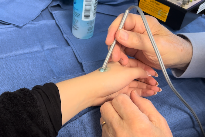 A doppler can be used to identify and evaluate the deep branch of the radial artery.