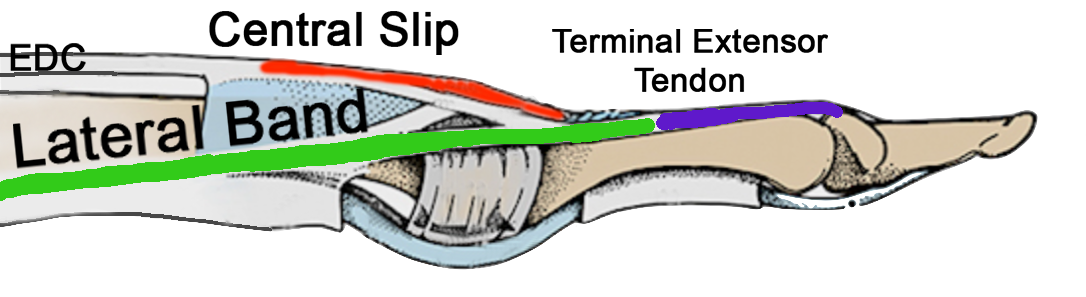 Terminal extensor tendon in purple.