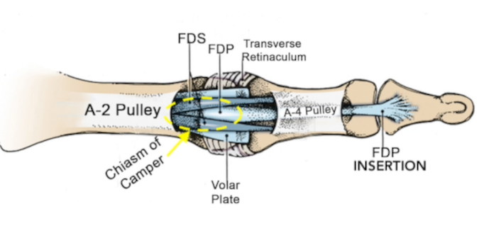 Palmar view showing FDP, FDS, Chiasma of Camper, Volar plate, and two major pulleys A1 and A2.