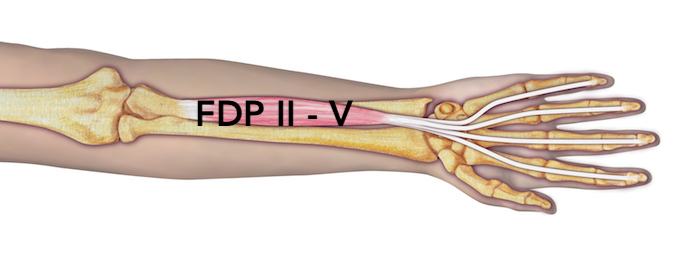 Flexor Digitorum Profundus (FDP II-V)
