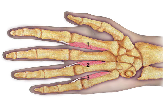 Note the third palmar interosseous muscle (3) on the radial side of the little metacarpal bone.