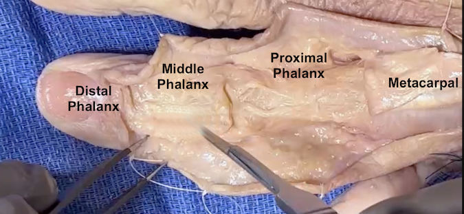 Dorsal anatomic dissection showing the index proximal phalanx.