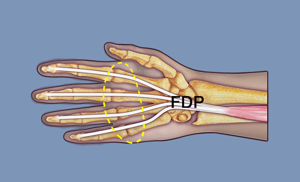 The yellow oval outlines the parts of the flexor digitorum profundi that are located in section 7.