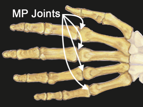 MP joints of the index, long, ring, and little fingers.