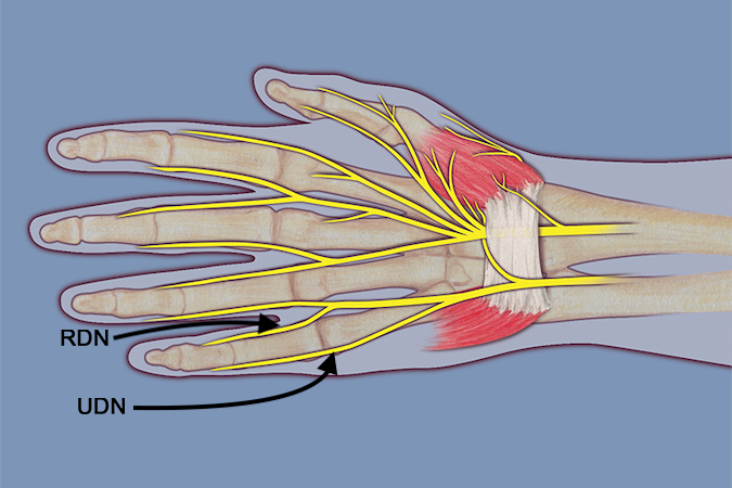 Radial and ulnar digital nerves of the little finger.