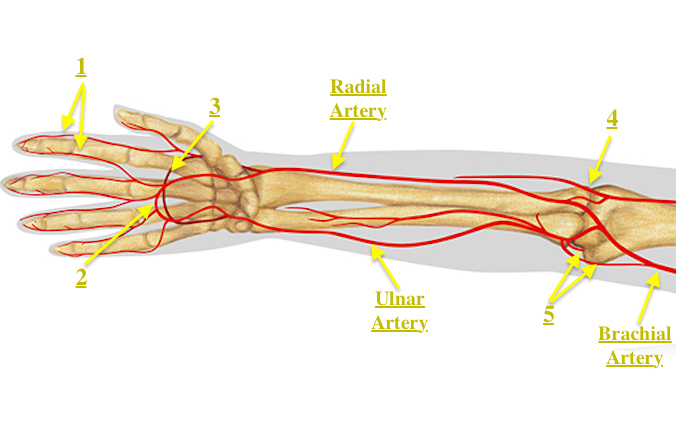 Note the radial artery, ulnar artery, brachial artery, 1 digital arteries, 2 superficial vascular arch, 3 deep vascular arch, 4 lateral collateral arteries, and 5 medial collateral arteries.