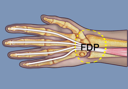 Note the FDP tendons in section 9 (yellow oval).